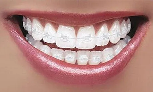 6 months Smile  wood green